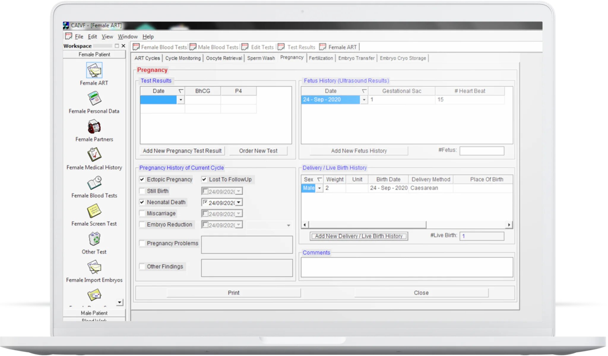 ivf lab software